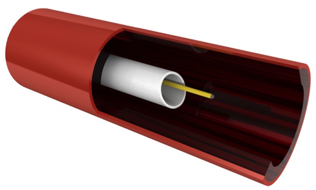 Illustrasjon som viser sensoren stående i blodstrømmen gjennom et kateter. 